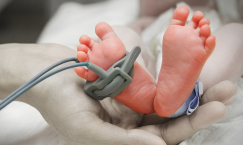 Prematuridade: entenda as causas e os cuidados necessários