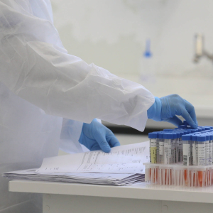 Estado tem 17 laboratórios credenciados para testes da Covid-19