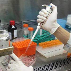 Covid-19: pesquisadores criam teste barato para unidades de saúde