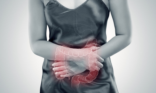 Conheça as possíveis causas de obstrução intestinal