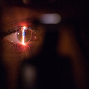 Alterações nos olhos podem apontar para doenças sistêmicas no organismo