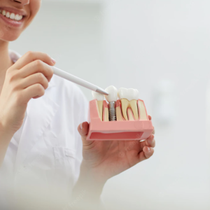 Implante dentário: entenda como funciona e quando é indicado
