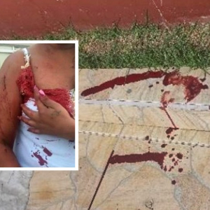 Com ciúmes do marido, mulher agride amiga com garfo de cozinha em Mafra