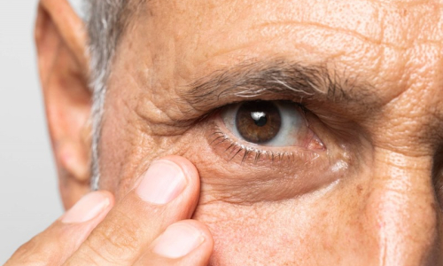 Diabetes: 4 complicações causadas pela doença que afetam a saúde dos olhos
