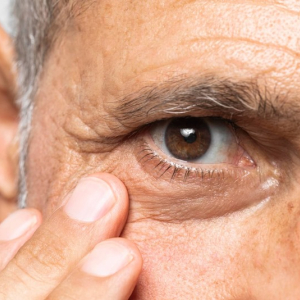 Diabetes: 4 complicações causadas pela doença que afetam a saúde dos olhos