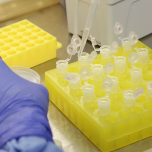 Planos de saúde terão de cobrir exames para novo coronavírus