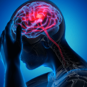 AVC: como identificar sintomas e se prevenir?