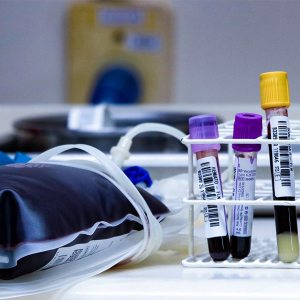 Dezembro Vermelho: Saúde reforça a prevenção e conscientização sobre o HIV/Aids
