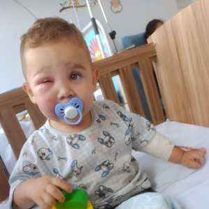 Criança de apenas 2 anos é hospitalizada após picada de inseto em creche
